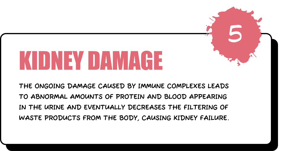 Kidney Damage - The ongoing damage caused by immune complexes leads to abnormal amounts of protein and blood appearing in the urine and eventually decreases the filtering of waste products from the body, causing kidney failure.