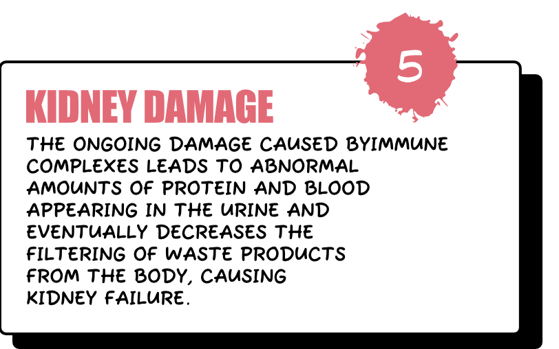 Kidney Damage - The ongoing damage caused by immune complexes leads to abnormal amounts of protein and blood appearing in the urine and eventually decreases the filtering of waste products from the body, causing kidney failure.